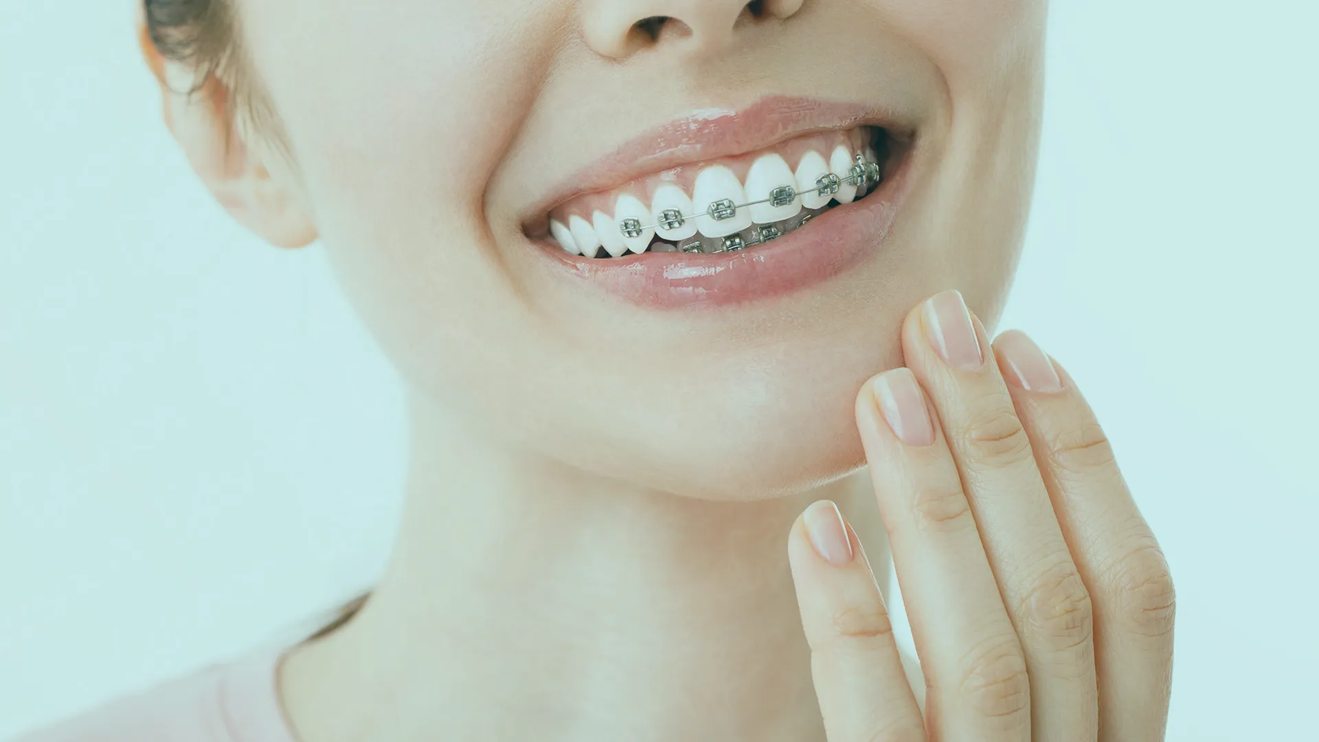 Orthodontics in Turkey, providing good orthodontic treatments and high-quality care for straightening teeth and improving smiles.