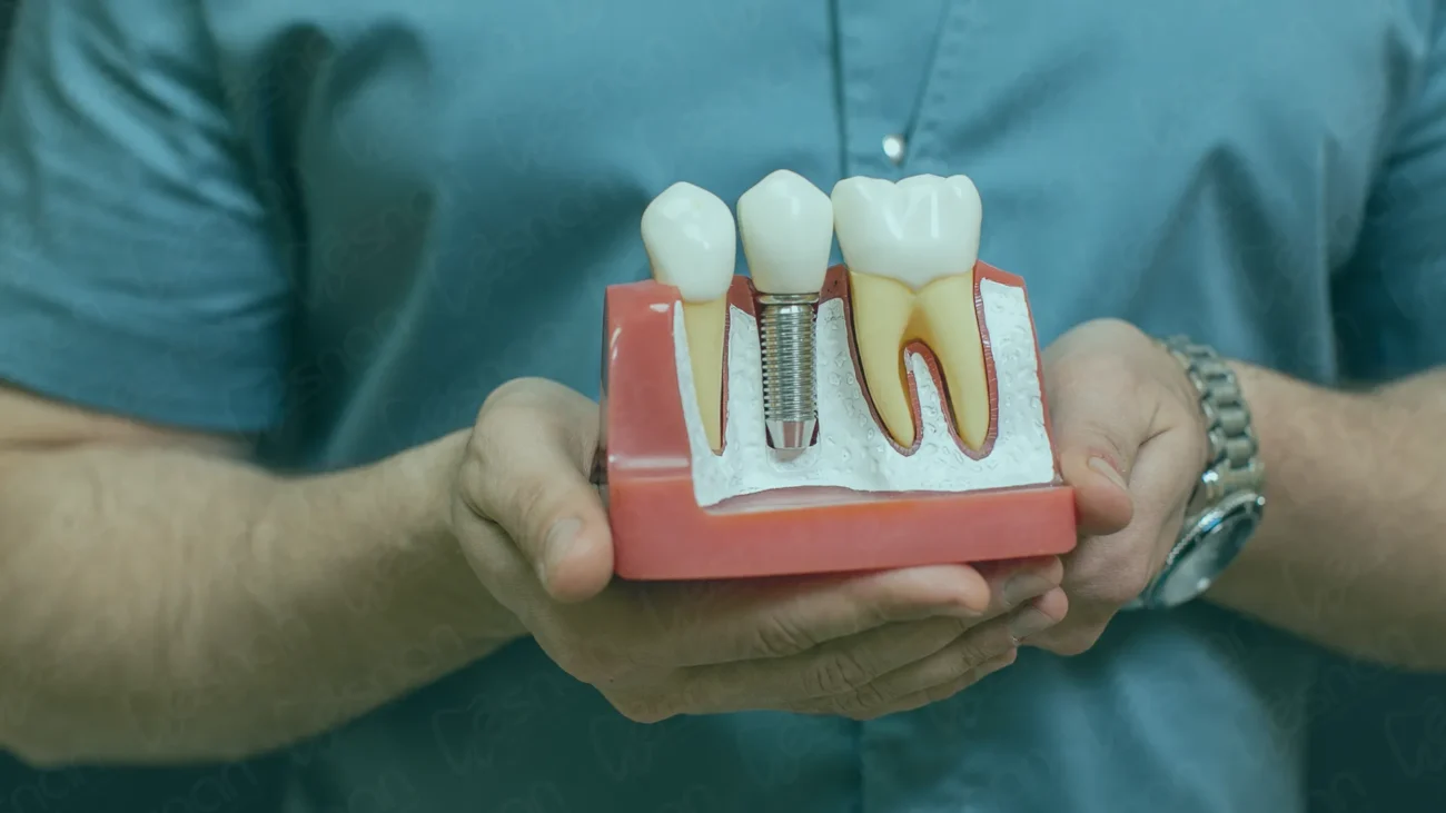 Explore the various treatments of dental implants in Turkey. From initial consultation to implant placement and restoration, achieve a confident smile.