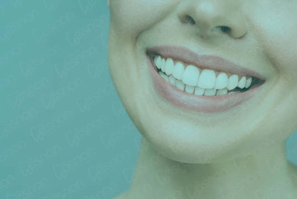 Discover the latest smile design trends for 2024. Stay ahead with cutting-edge dental aesthetics. Image: "2024-smile-design-trends."