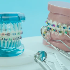 Patients seeking dental braces in Turkey, particularly Istanbul, can now achieve desired outcomes in a shorter timeframe than previously thought.