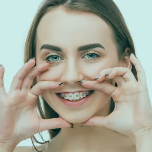 Whether you're exploring smile design in Istanbul, Turkey, understanding the intricacies of orthodontic treatments and their role is important.