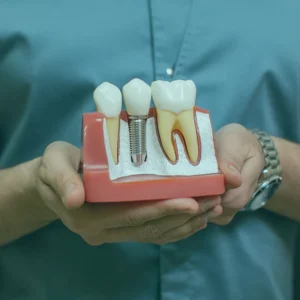 Learn essential tips for implant care to ensure longevity and health. Discover best practices for maintaining your dental implants effectively