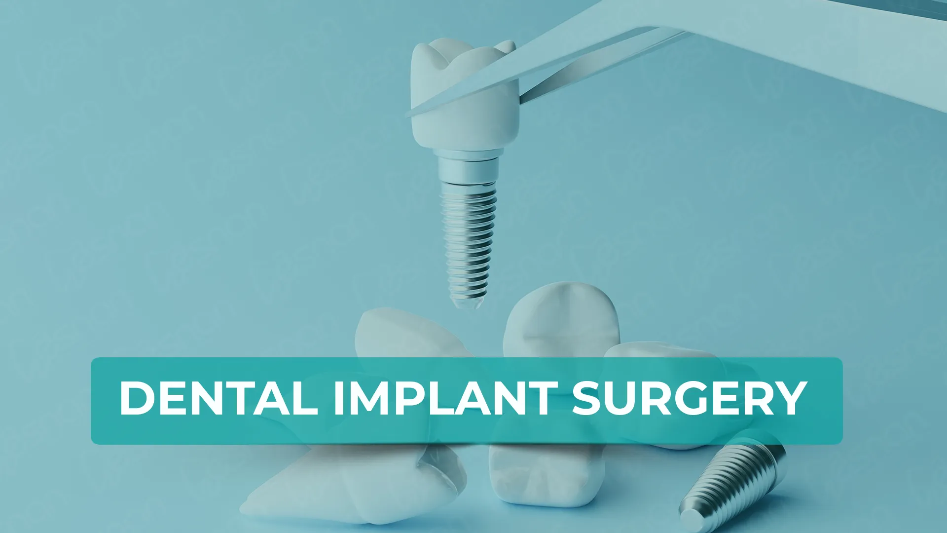 Get answers to your questions about dental implant surgery in Turkey. Explore procedures, costs, recovery, and why Turkey is a top destination for dental care.