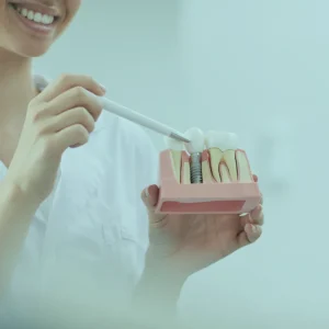 Dental implants in Turkey are important in the treatment of tooth loss because they will enable you to regain the function and beauty of the lost teeth.