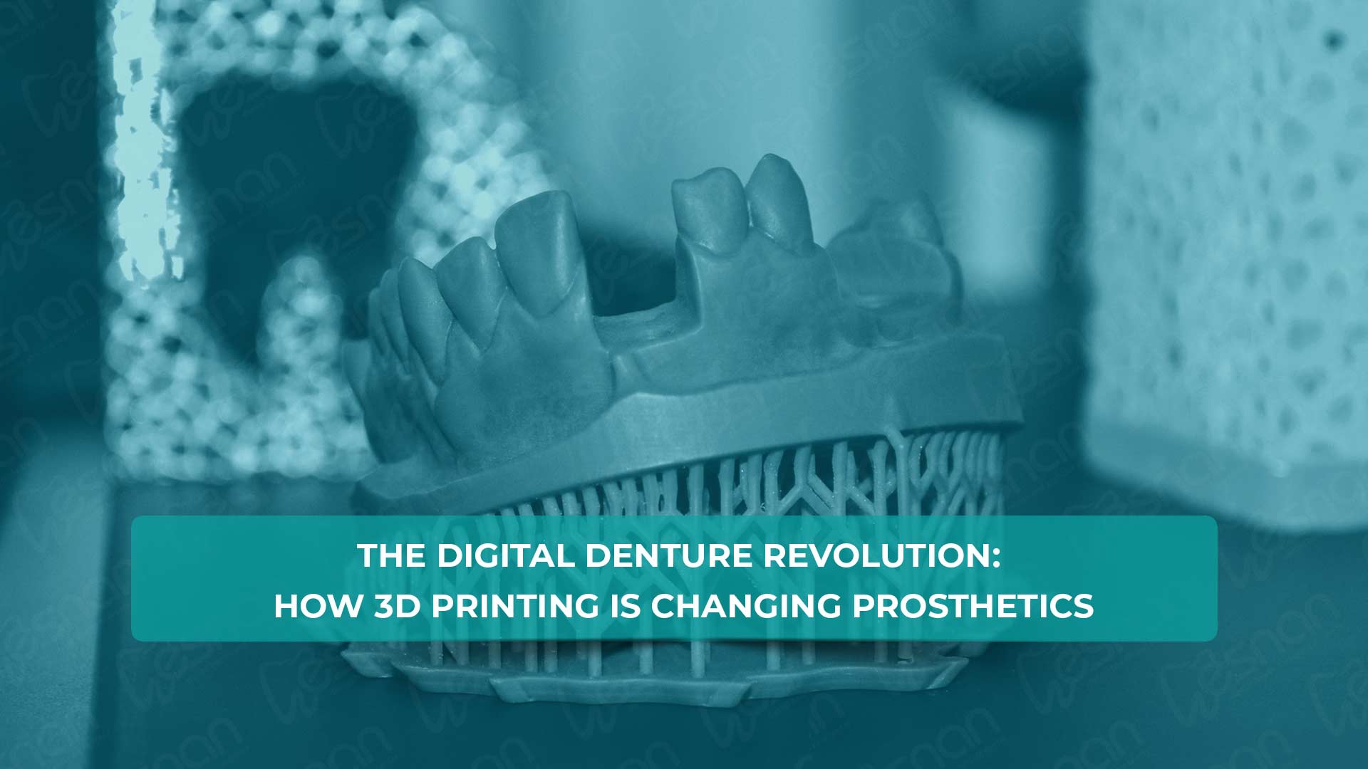 Explore how 3D printing is transforming prosthetics with dentures in Turkey. Learn about the precision, customization, and efficiency.