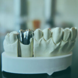 The specialist in dental implants in turkey will execute a thorough examination, which will include an x-ray and 3D imaging.