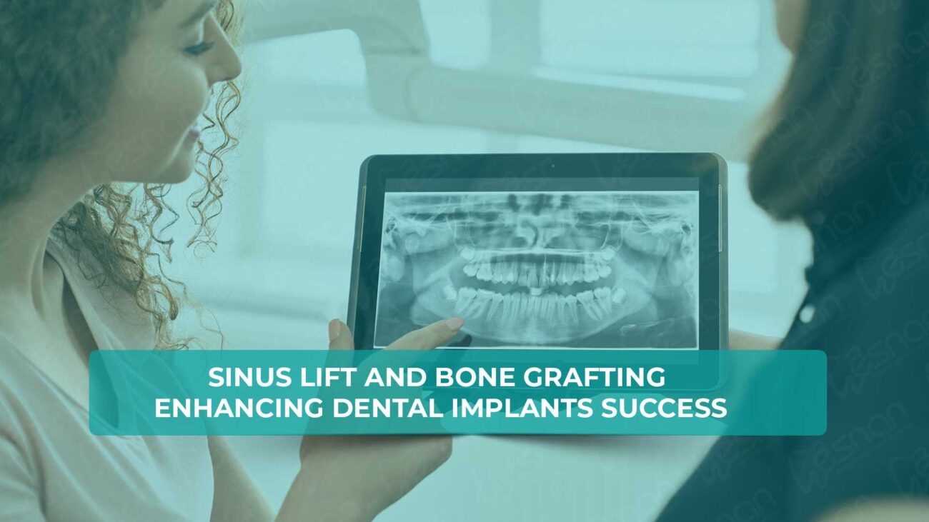 Get detailed insights into the procedure of sinus lift in Turkey, a key technique to prepare for dental implants and improve oral health