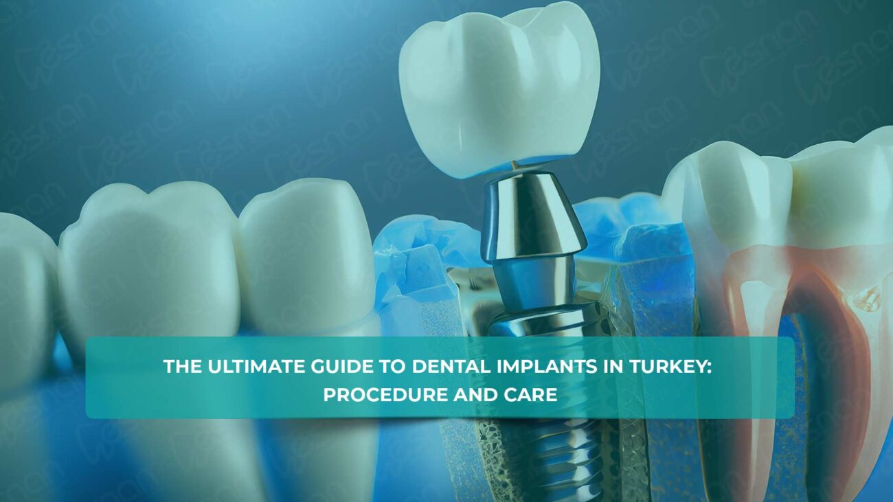 Are dental implants in Turkey safe? Explore our trusted procedures and experienced professionals for secure, lasting solutions.