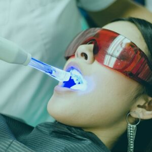 When it comes to teeth whitening in Turkey, one of the key factors that sets it apart is the range of innovative treatments available.
