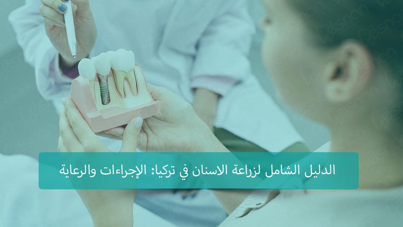 الدليل الشامل لزراعة الأسنان في تركيا: الإجراءات والرعاية