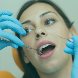 Bruxism Botox treatment in Istanbul with a focus on dental care