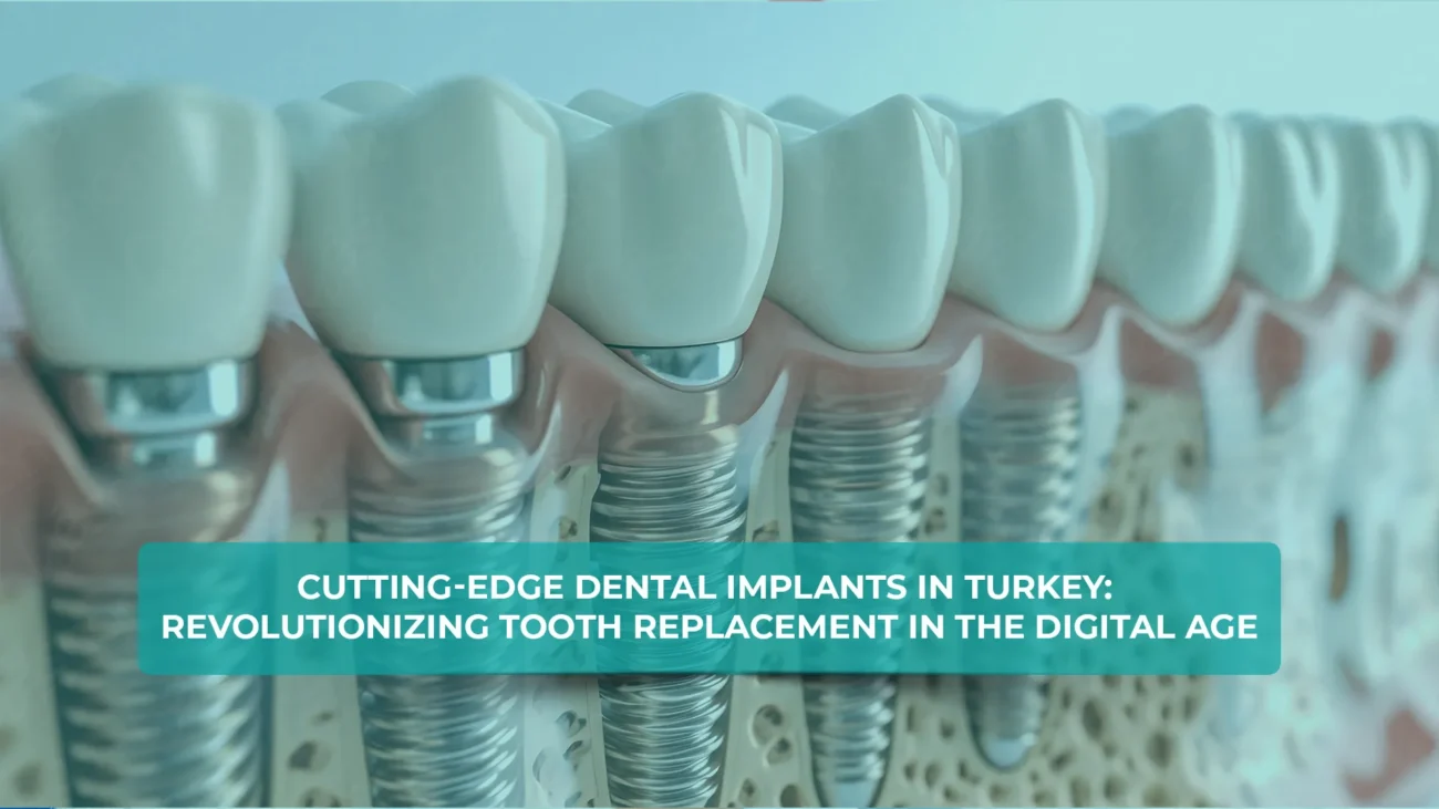 Dental implants Turkey: Advanced technology for a perfect smile