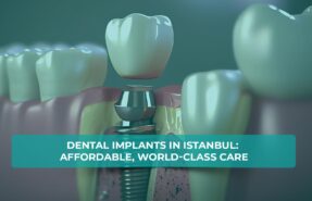 Dental implants in Istanbul, offering affordable and world-class care.
