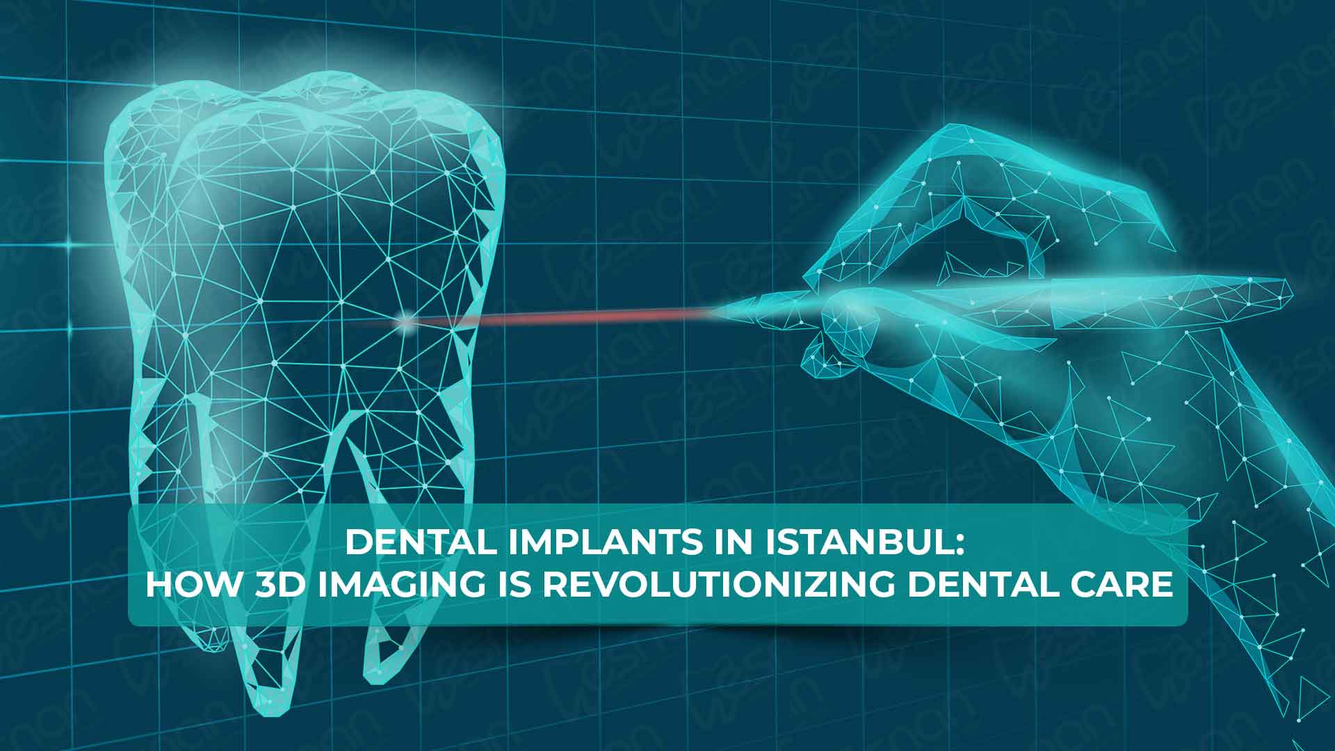 Dental implants in Istanbul: How 3D imaging is revolutionizing dental care