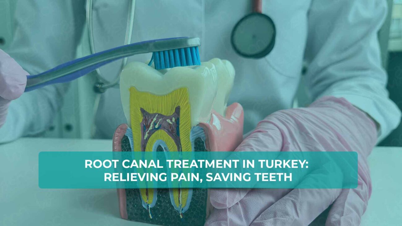 Root Canal Treatment in Turkey: Relieving Pain, Saving Teeth