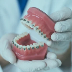 The benefits of early orthodontic treatment in Istanbul