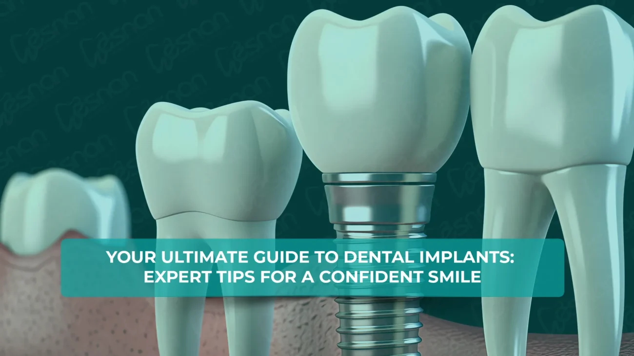 Your ultimate guide to dental implants in Turkey
