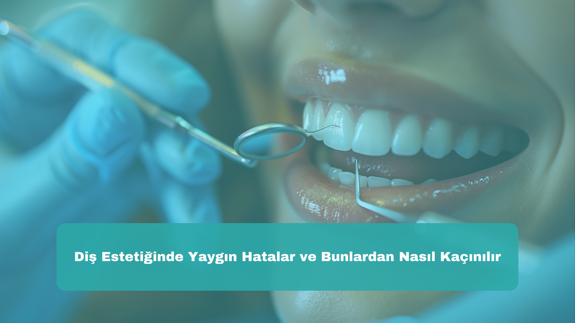 Diş Estetiğinde Yaygın Hatalar ve Bunlardan Nasıl Kaçınılır