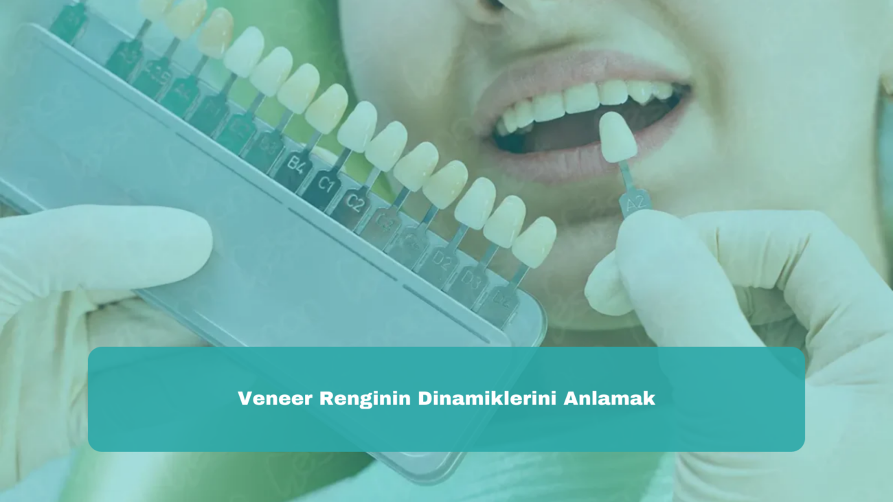 Veneer Renginin Dinamiklerini Anlamak