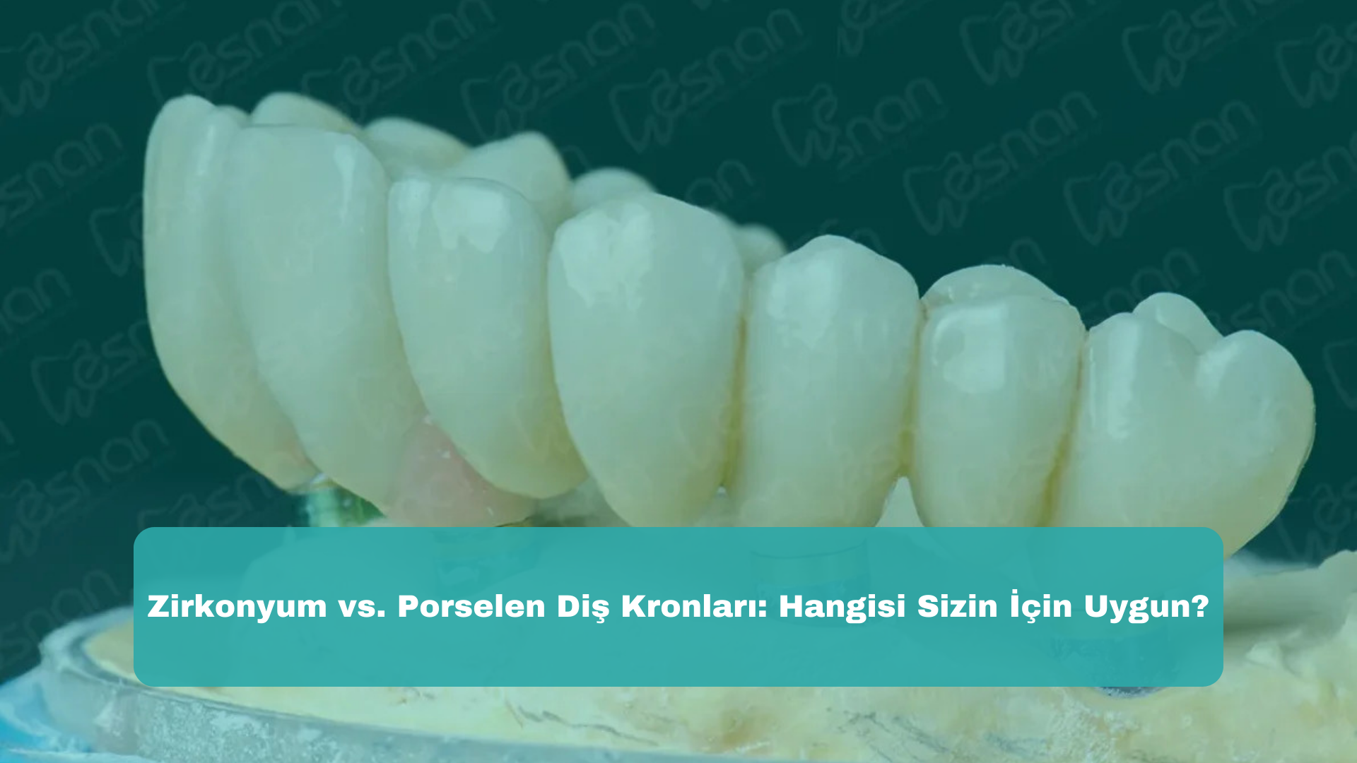 Zirkonyum vs. Porselen Diş Kronları: Hangisi Sizin İçin Uygun?